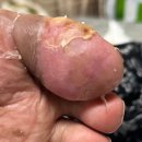 메디홈케어 이미지