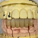 나무 치과기공소 이미지