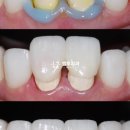 훤치과기공소 이미지