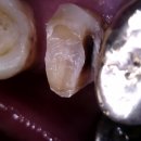 용치과기공소 이미지