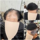 한양수자인평촌리버뷰 아파트 상가 앞 | 맞춤가발과 증모술 없이 남자 탈모 머리숱을 극복시키는 미용실