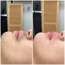 아나덴슈가링왁싱수원영통역점 이미지