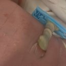 w-37 | 잊을까봐 남겨두는 제왕절개 후기 (37w6d/세종트리니움)