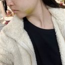 웃음가득약국 | 사랑니 한 번에 4개 발치한 후기, 생생한 후기, 실비 환급