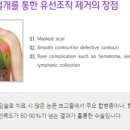 미큐의원 네이버블로그