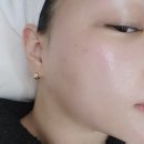 삼성생명 앞 노상 | 노원페이스왁싱 잘하는 엘제이뷰티 손빠르고 안아픈 왁싱