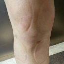 외동튼튼정형외과의원 이미지