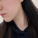 피오 | 대구칠곡피부과 추천 브이라인 안아픈리프팅 스컬피오 리프팅레이저 후기