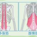 허리를 삐끗하고 빨리 고치기 위한 올바른 대처법 이미지