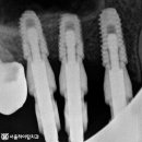 서울하이탑치과의원 이미지