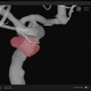 뉴로메디 이미지