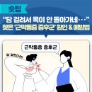 “담 걸려서 목이 안 돌아가네‧‧‧” 잦은 ‘근막통증 증후군’ 원인 & 예방법 이미지