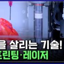 &#39;질병 치료&#39; 새로운 돌파구! 암세포 잡아내는 &#39;3D 바이오프린팅 기술&#39;·심근경색 막아주는 &#39;레이저 기술 이미지