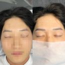 스칼프랩앤뷰티 속눈썹&눈썹&탈모 의정부점 | 의정부눈썹 잘하는곳 “스칼프랩앤뷰티” 패더링기법으로 남자 눈썹관리 후기