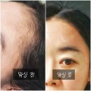 율하유치원 | 장유율하왁싱 잘하는 곳 홍쓰네뷰티 김해 헤어라인왁싱 후기