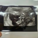 대성산업가스 반월공장 | 19주차 임산부의 초음파 성별 공개