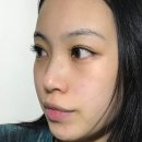 [대전]나노-필의원 : 라비앙 비비레이저 생생 후기1˙ᵕ˙