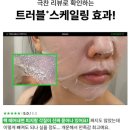 내돈내산후기 이옴 트러블 패치 마스크 진짜 효과있을까?