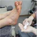 키스네일 네이버블로그