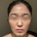 제이제이테라피 | 선릉역피부관리 추천 역삼동피부관리 제이제이뷰티라운지 앰플 나노관리 후기
