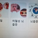 靑松 건강칼럼 (936)... ‘첫차’ 타고 하늘나라로 떠난 ‘방실이’ 이미지