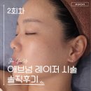 차딱지 | [관리기록] 애브넘 레이저 2회차 후기｜딱지 없는 레이저, 생각보다 효과 있을까?