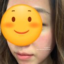 그랑메디의원 이미지