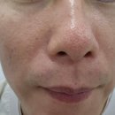 초이스뷰티샵 | [구래동]남자 모공관리 &#39;초이스 뷰티&#39; 방문 후기