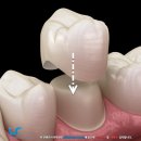 네이치과기공소 이미지