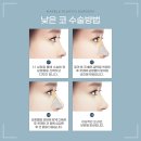 마블성형외과의원 이미지