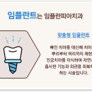 삼성올바른치과의원 네이버블로그