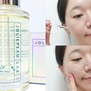 닥터엔 | 30대 이후 탄력이 신경쓰여 찾게 된 닥터엔 보르피린 앰플 찐 사용 후기