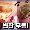 레푸스 서면점