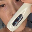 6월 올영세일 기간 필수템! 탄력 홈케어 디바이스 추천, 듀얼소닉 하이이피 더블샷 효과