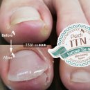 모모네일 이미지