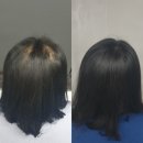 제이엔제이뷰티 | 판교눈썹문신 두피타투 헤어라인 장인을 찾았다! 다잘하는 켈리