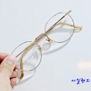 008-운정1-008 | 노안수술 후 뿌옇게 흐려보임 어떻게 해결하나요?