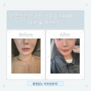 앤봄의원 이미지