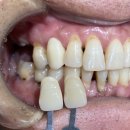 블루치과기공소 이미지