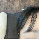 서울 강남구 도곡동 탈모관리 양재오라클피부과의원 위치 가격 후기