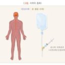 수면마취 전신마취 장점 단점 부작용 후유증 이미지