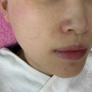 다올2호 | [동탄 에스테틱] 피부 각질케어 고민으로 방문한 ‘다올뷰티 동탄점‘ 후기, 동탄 피부관리, 동탄 각질케어