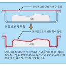 디컴즈 이미지