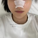 죽전 피부관리 추천 세라링플래닝 받은 후기