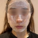 예스치과의원 | 포항 밴스의원 오픈첫날 내돈내산 솔직후기