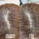 베네핏 에스테틱 이미지