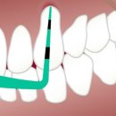 광명77플란트치과의원 이미지