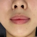 르헤브 스킨케어