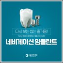 수원임플란트치과 후기 참고한다면