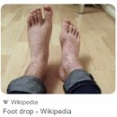 의사들은 허리통증주사 맞나요? [서부통신경외과] 의사주사후기, 대구목디스크병원, 서부정류장역